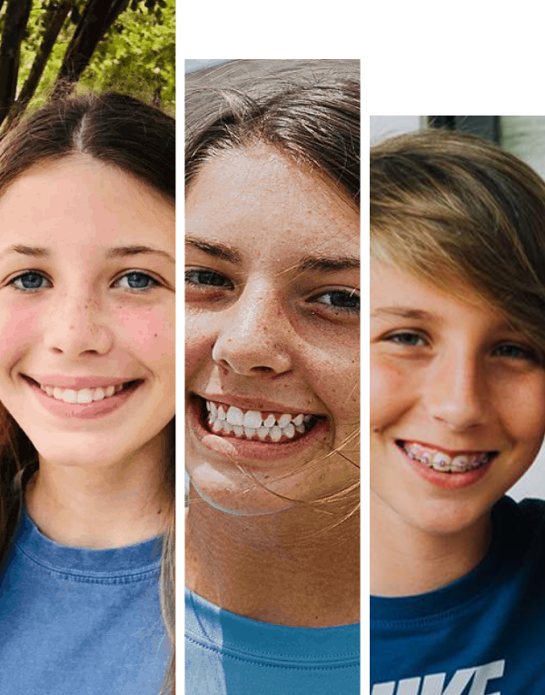 Overbite or Buck Teeth: THE STEPS TO THE SMILE YOU'VE ALWAYS WANTED -  Sherman & Balhoff Orthodontics